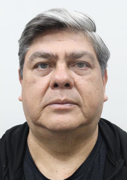 CARLOS ALBERTO