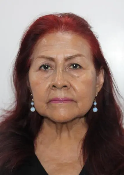 NILDA ESPERANZA